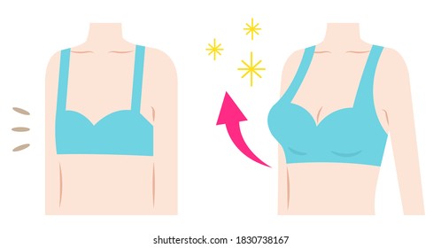 breast augmentation before after woman body illustration. Body care and beauty concept. 