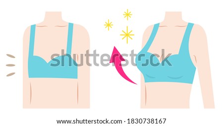 breast augmentation before after woman body illustration. Body care and beauty concept. 