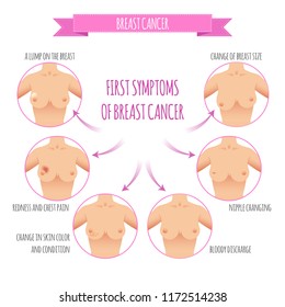 Breast cancer awareness. Info for Self-examination. Vector illustration Symptoms, diagnostics. Medicine, pathology, anatomy, physiology, health Healthcare poster or ads