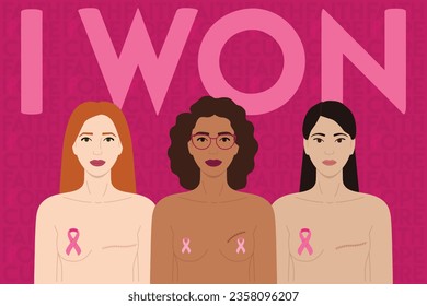 Woman after mastectomy. A girl without breasts tries on a breast prosthesis.  Breast cancer. Vector illustration. 28797527 Vector Art at Vecteezy
