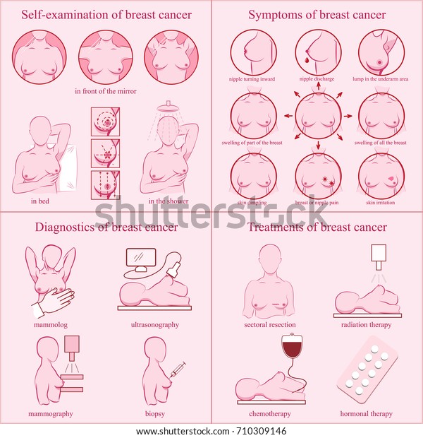 Breast cancer awareness set. Self-examination,\
symptoms, diagnostics, treatments. Medicine, pathology, anatomy,\
physiology, health. Info. Vector illustration. Healthcare poster or\
banner template.
