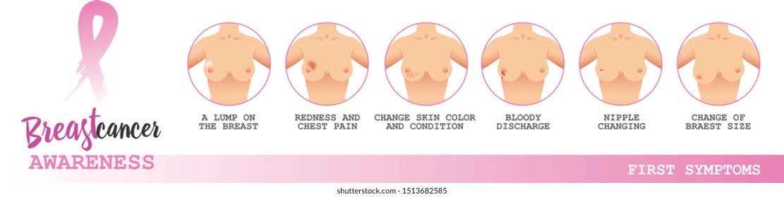 Breast cancer awareness vector poster. Self examination, first symptoms. Vector illustration for your design
