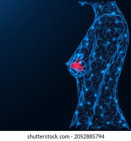 Breast cancer. Female breasts with symptoms of the disease. A low-poly construction of interconnected lines and dots. Blue background.