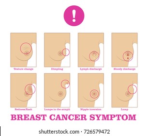 Breast cancer symptom. Warning signs and danger, unusual changes and pain. Information poster. Female healthcare concept. White background vector illustration