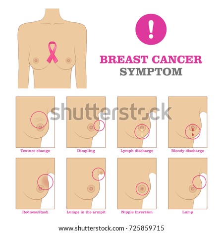 Opinion you unusual breast cancer pictures Unusual breast cancer pictures