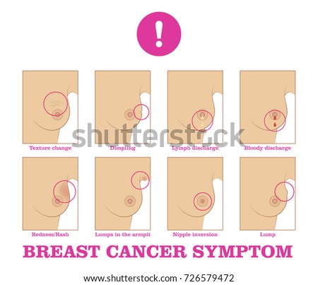 breast cancer sign warning Angel an gay