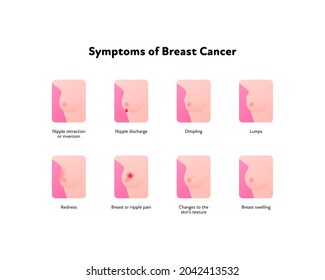 Breast Cancer Symptoms Infographic. Vector Flat Healthcare Illustration. Set Of Icon Symbol With Symptom And Text Isolated On White Background. Design For Awarness Month, Poster