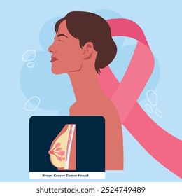 breast cancer tumor found in women body xray scan anatomy flat illustration