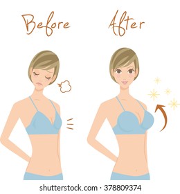 Breast Enhancement