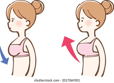 Breast Enhancement Before and After Beauty Female Illustration