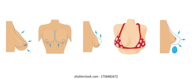 Breast icon set. Cartoon set of breast vector icons for web design isolated on white background