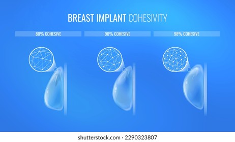 Breast implant density types for mammoplasty in a realistic style. Infographic concept for plastic surgery clinic banner. Vector illustration in futuristic style with light effects