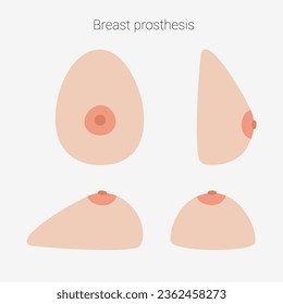 Breast prosthesis. Breast prosthesis for breast cancer patient after mastectomy. Vector illustration.