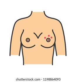 Breast rash color icon. Skin irritation or dimpling. Nipple dermatitis, abscess, dry skin. Breast cancer symptom. Isolated vector illustration