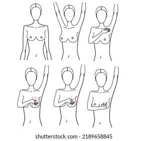 BREAST SELF-EXAM, WOMAN BREAST SELF-EXAM, Breast Cancer VECTOR, cancer awareness 