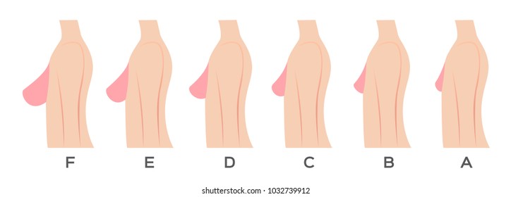 Breast Size And Type Vector