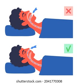 Breathing in asleep. A man laying on his back with an open, closed mouth. Incorrect and correct airflow. Air going through nose and mouth. Snoring, sleep apnea problem. A vector cartoon illustration.