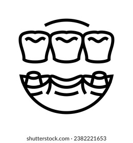 bridge dental procedure line icon vector. bridge dental procedure sign. isolated contour symbol black illustration