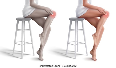 Bright and discoloured Illustrations with woman that sitting on the stool, rubbing her knee and suffering from pain in knee. Vector illustration isolated on white background. 