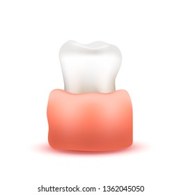 Bright realistic tooth in gum, dental treatment concept on white