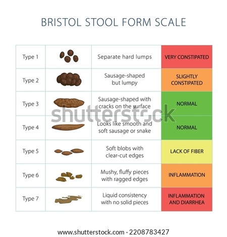 Bristol stool scale table. Medical diagnostic infographics, different poop type from constipation to diarrhea. Vector illustration for posters, articles about helthy diet, digestive system.