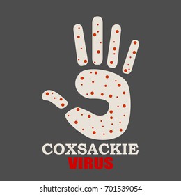 Brochure, report or flyer design background. Scientific medical designs. Coxsackie virus text. Human palm with red dots