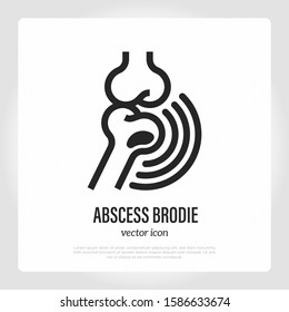 Brodie Abscess Thin Line Icon. Inflammation And Pain In Joint. Vector Illustration For Medical Clinic.