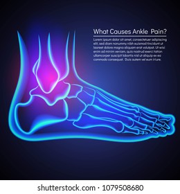 Broken Ankle Xray Anatomy Ankle Pain Stock Vector (Royalty Free ...