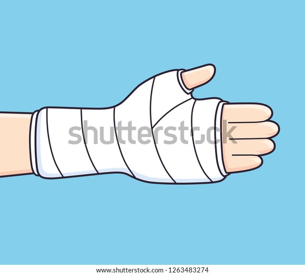 Broken Arm Bone Fracture Trauma Orthopedic Stock Vector (Royalty Free ...