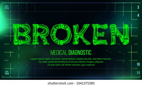 Broken Banner Vector. Medical Background. Transparent Roentgen X-Ray Text With Bones. Radiology 3D Scan. Medical Health Typography. Futuristic Technology Illustration