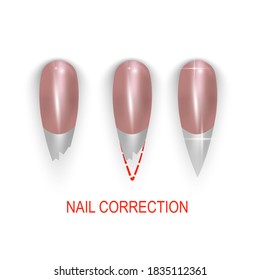 Broken or bitting nail correction, illustration set on white background. Vector eps 10 format