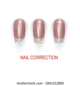 Broken or bitting nail correction, illustration set on white background. Vector eps 10 format