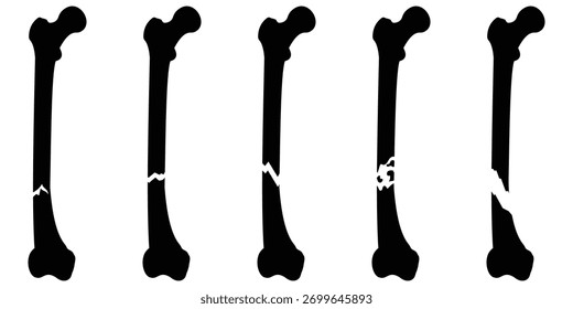Conjunto de ícones de ossos quebrados - Símbolos de anatomia de fratura médica e vetor de saúde 
Ilustração