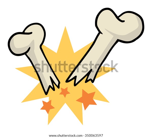 Broken Bone Vector Illustration Stock Vector Royalty Free 350063597   Broken Bone Vector Illustration 600w 350063597 