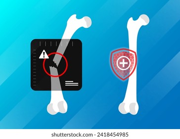 Broken Bone x ray Human skeleton anatomy concept. Medical banner for clinic or hospital. Flat vector illustration