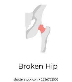 Broken Hip, flat vector icon