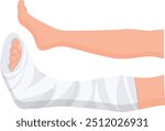 Broken leg Ankle and foot Bandages on the legs