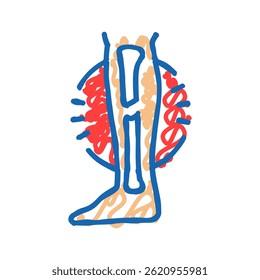 fratura de perna quebrada lesão ícone doodle esboço vetor. fratura de perna quebrada sinal de lesão. símbolo isolado ilustração