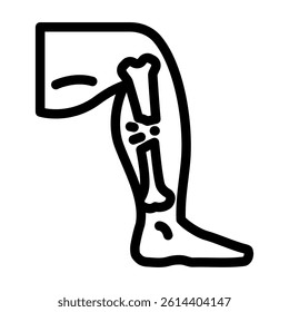 broken leg fracture injury line icon vector. broken leg fracture injury sign. isolated contour symbol black illustration