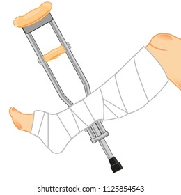 Broken Leg Gypsum Crutchesvector Illustration Stock Vector (Royalty ...