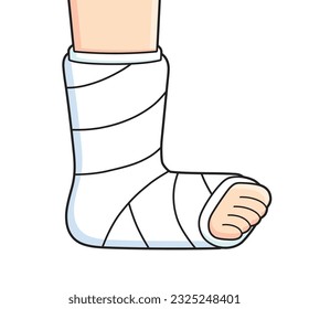 Broken leg with orthopedic cast isolated vector illustration