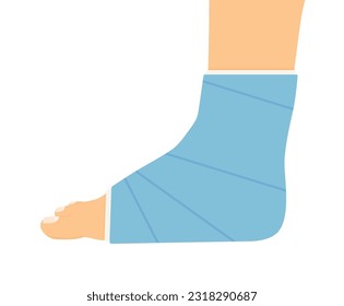 pierna rota con ilustración vectorial de yeso
