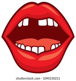 broken or lost teeth vector illustration