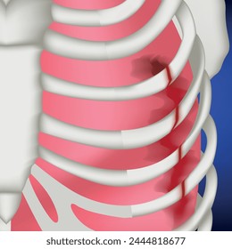 Broken ribs of a man with lung damage. Medical poster, vector illustration