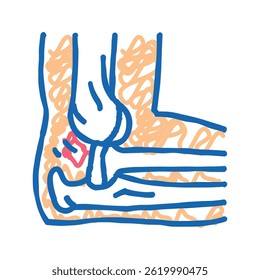 gebrochene Smartphone-Bildschirm doodle Symbol Skizze Vektor. defektes Smartphone-Bildschirmzeichen. einzelne Symbolgrafik