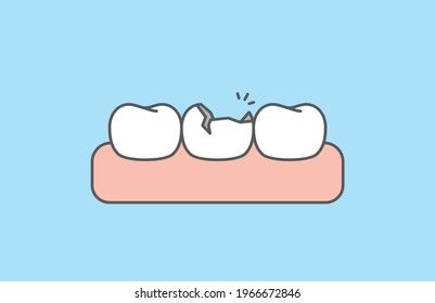 The broken tooth white teeth and gums illustration vector design on blue background. Dental care concept.