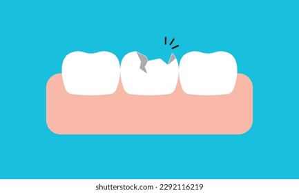 Diseño vectorial de ilustraciones de encías y dientes blancos rotos sobre fondo azul. Concepto de cuidado dental.