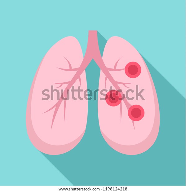 気管支炎の肺のアイコン ウェブデザイン用の気管支炎の肺のベクター画像アイコンの平らなイラスト のベクター画像素材 ロイヤリティフリー