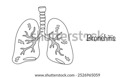 Bronchitis. Inflammatory disease of the bronchial tree. Swelling and large amounts of mucus in the airways due to inflammation make it difficult for air to reach the lungs. Vector illustration.