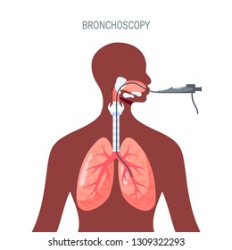 Bronchoscopy - lungs diagnotic concept. Vector illustration in flat style. Template for web banners, advertising, posters, infographics etc.